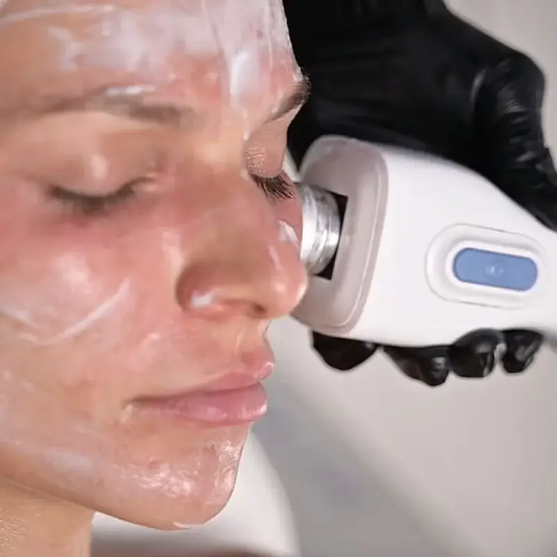 GlacialSkin facial cooling treatment at Prairie Glow Aesthetics